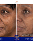 D'Gesichtscrème Mask