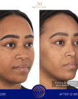 D'Gesichtscrème Mask