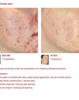 The Skin Biotic