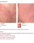 The Skin Biotic