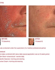 The Skin Biotic