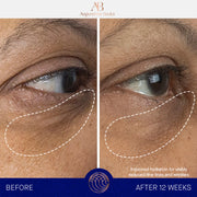 The Eye Cream Full Set 15 ml.