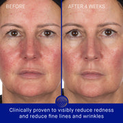 The Hydrogel Face Mask