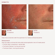 The Skin Biotic