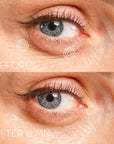Eye Precision Mask