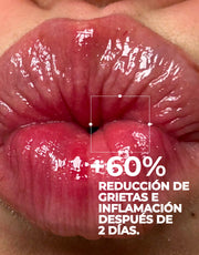 Lip Balm Ultra Repair Centella Peach
