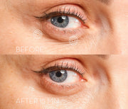Eye Precision Mask