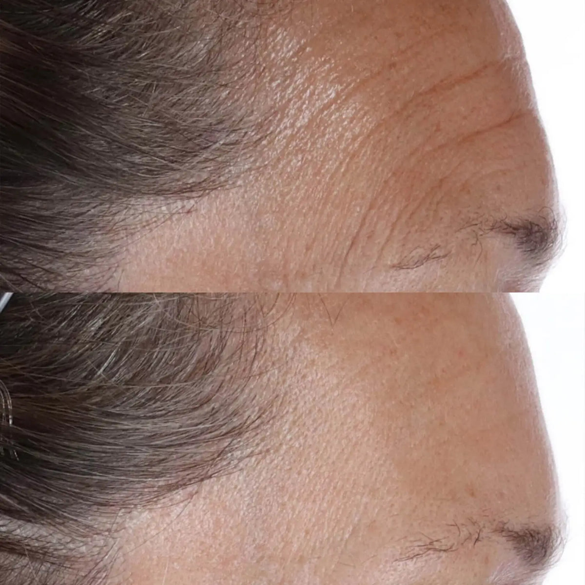 ESSENTIAL FX CHIA OIL - Centro de Estética Itziar y Mariángeles