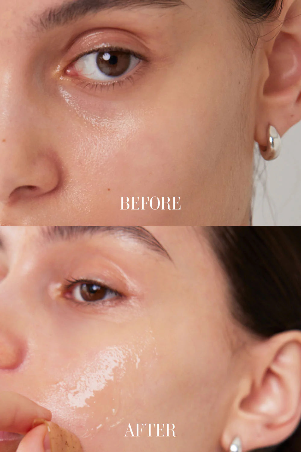 PATCHS POUR LES YEUX LOTUS MELIGHT 