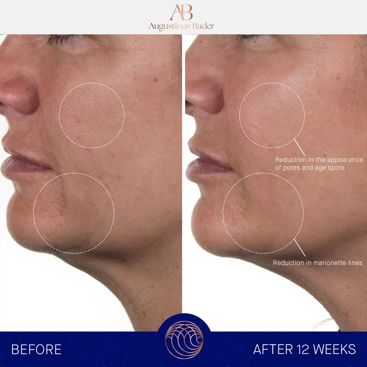 De Rijke Crème 15 ml. 