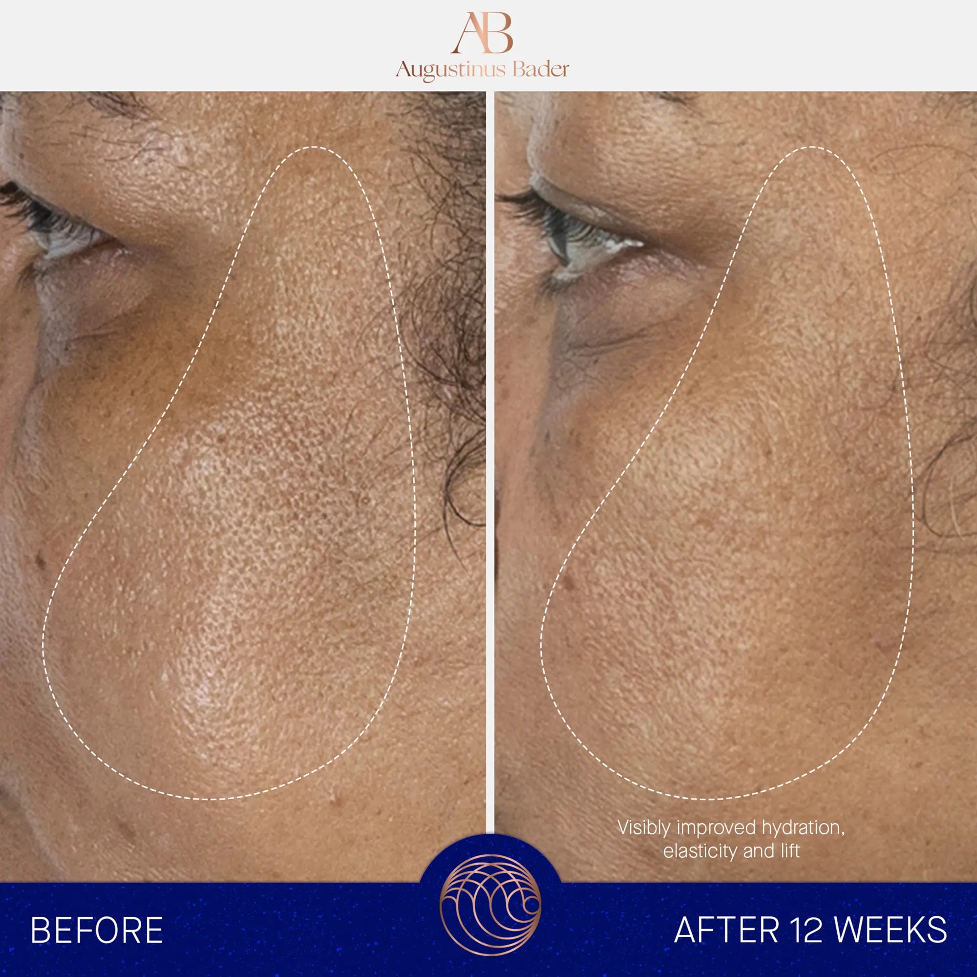 Serum cijeli set 30 ml. 
