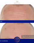 Serum s retinolom 