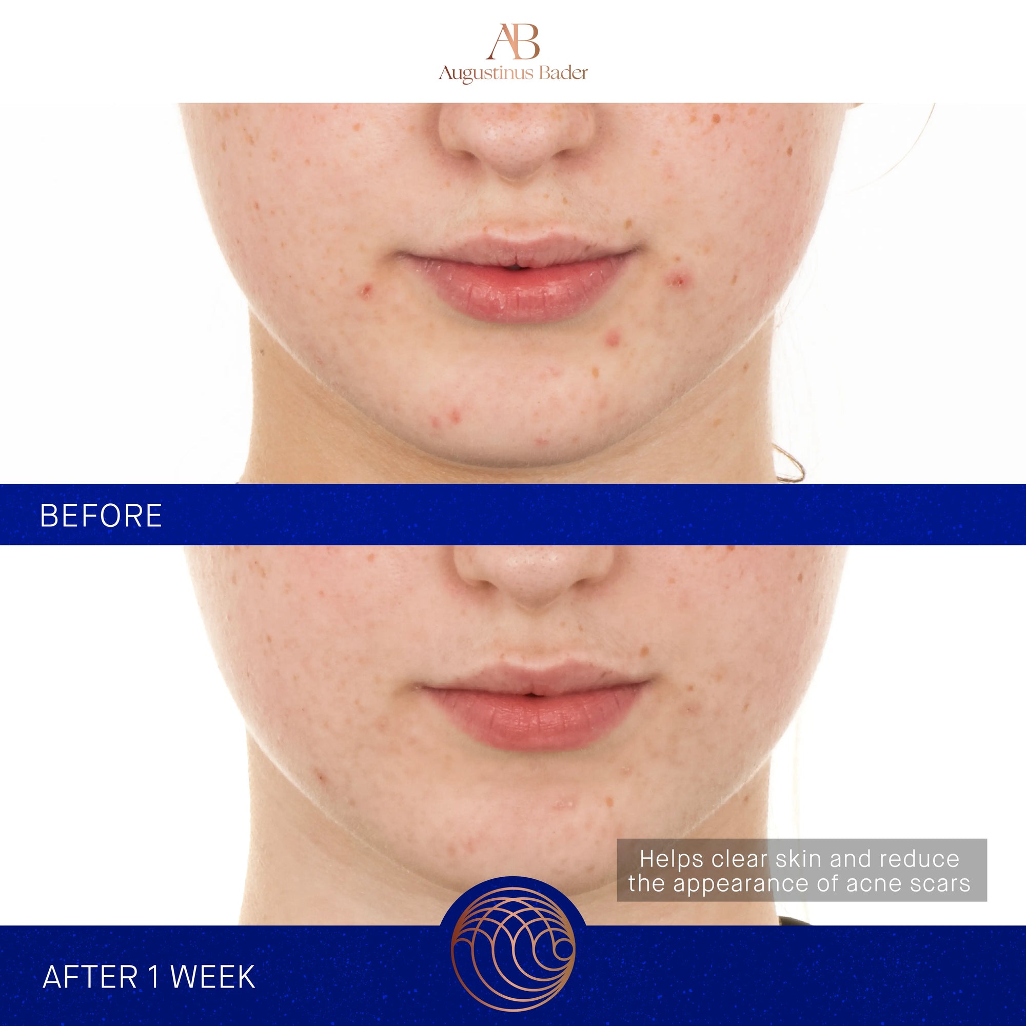 Serum s retinolom 