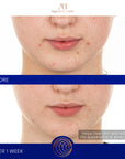 Serum s retinolom 