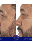 Serum s retinolom 