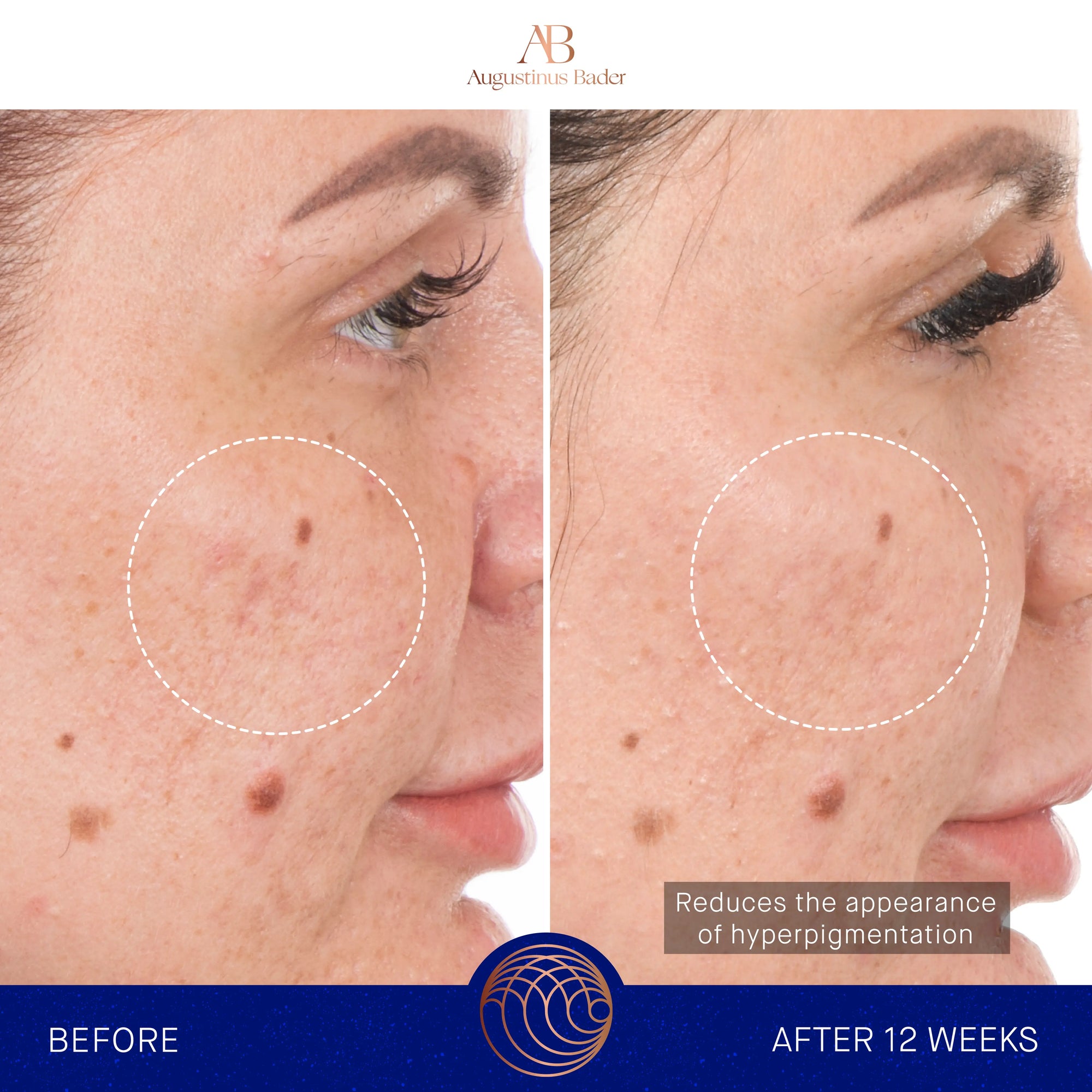 Serum s retinolom 