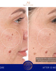 Serum s retinolom 