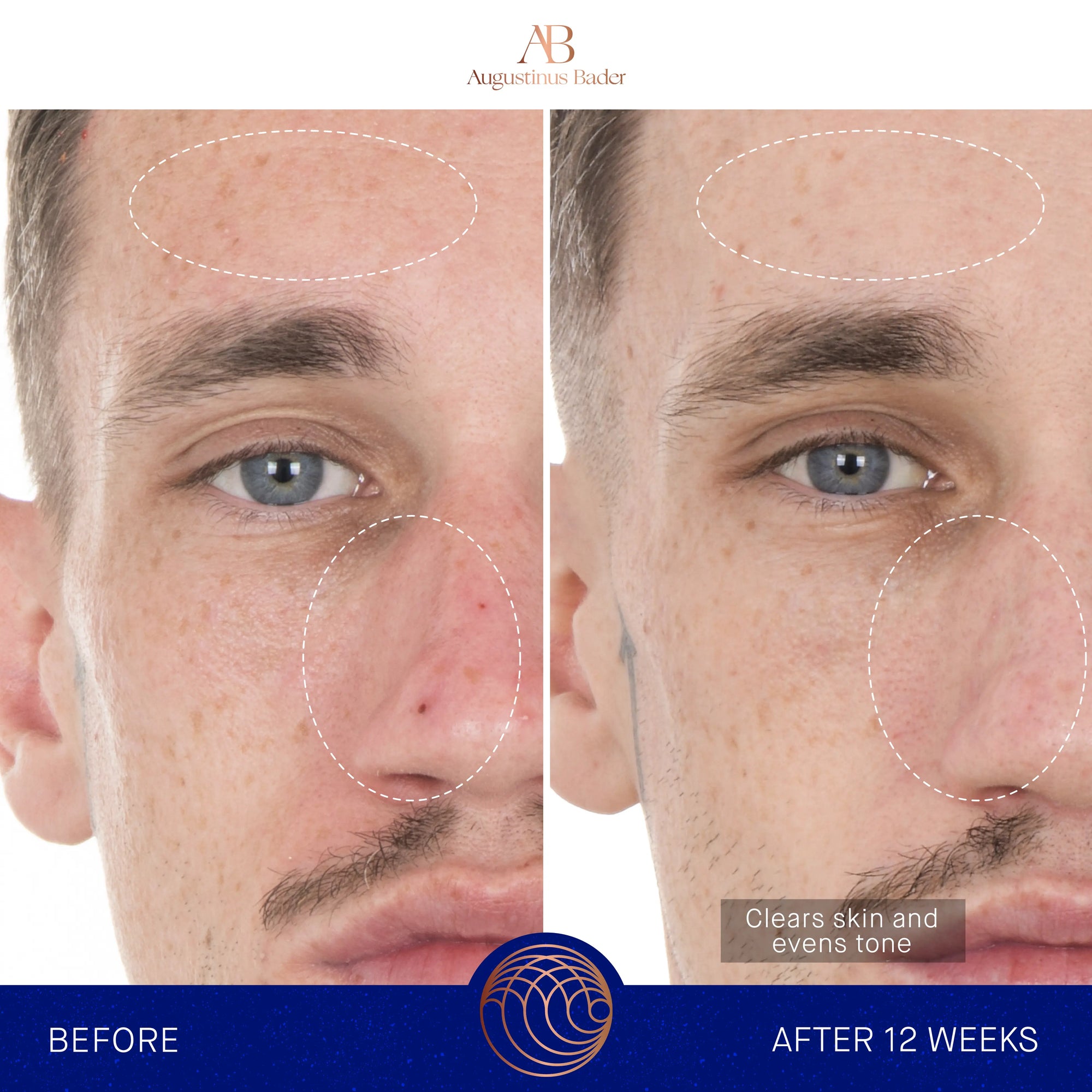 Serum s retinolom 