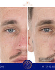 Serum s retinolom 