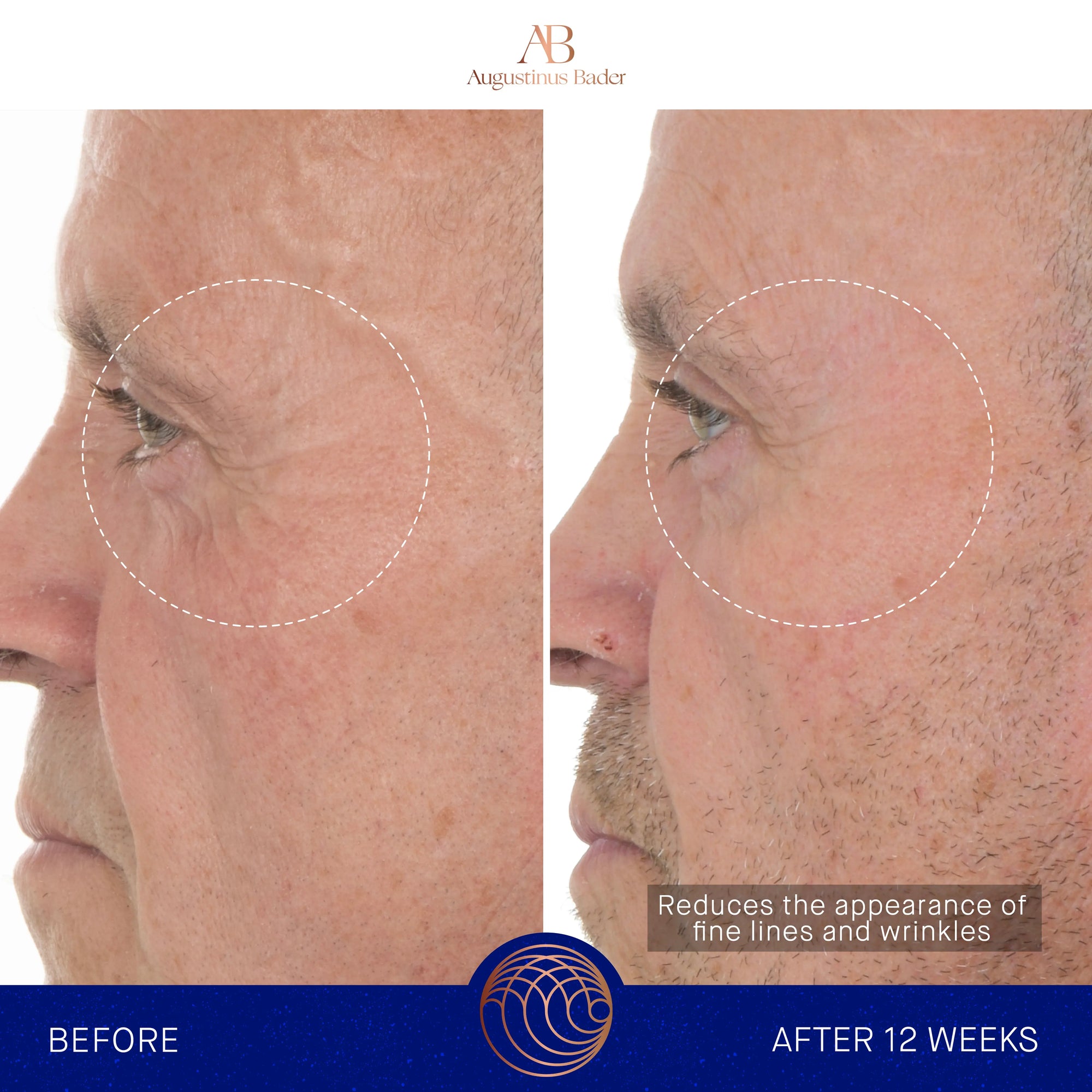 Serum s retinolom 