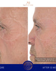 Serum s retinolom 