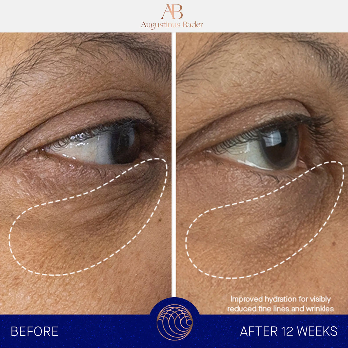 The Eye Cream Full Set 15 ml.