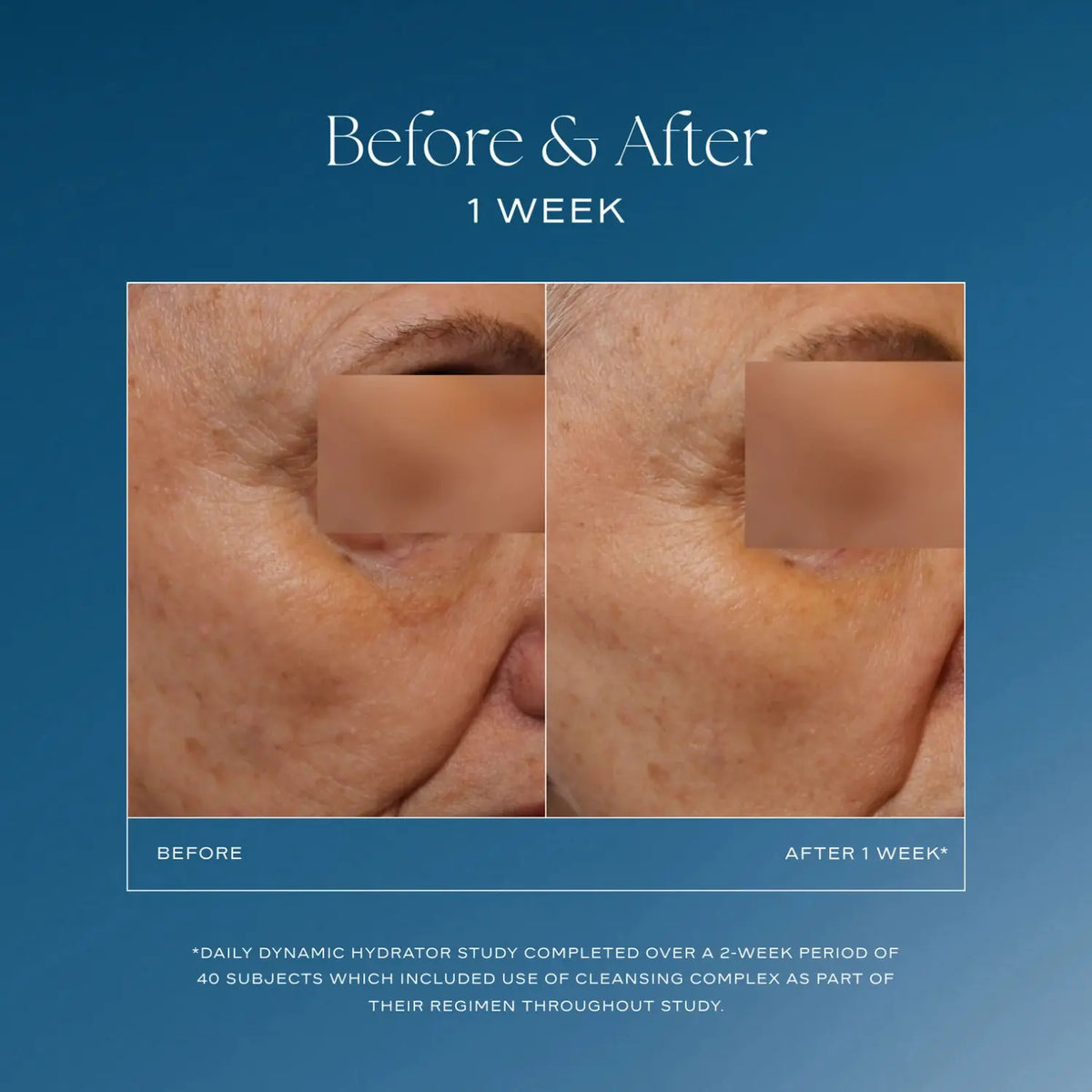 Daily Dynamic Hydrator