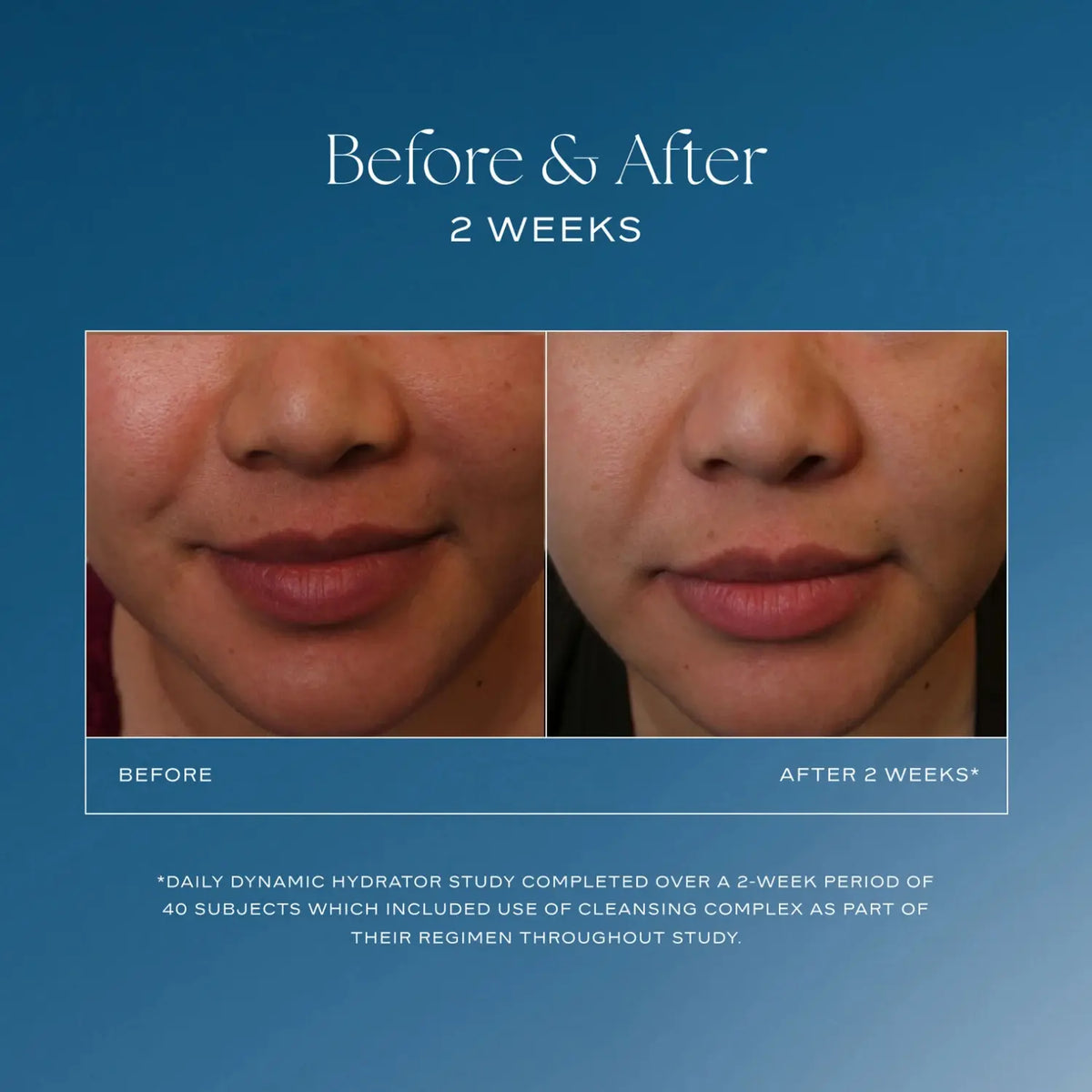 Daily Dynamic Hydrator