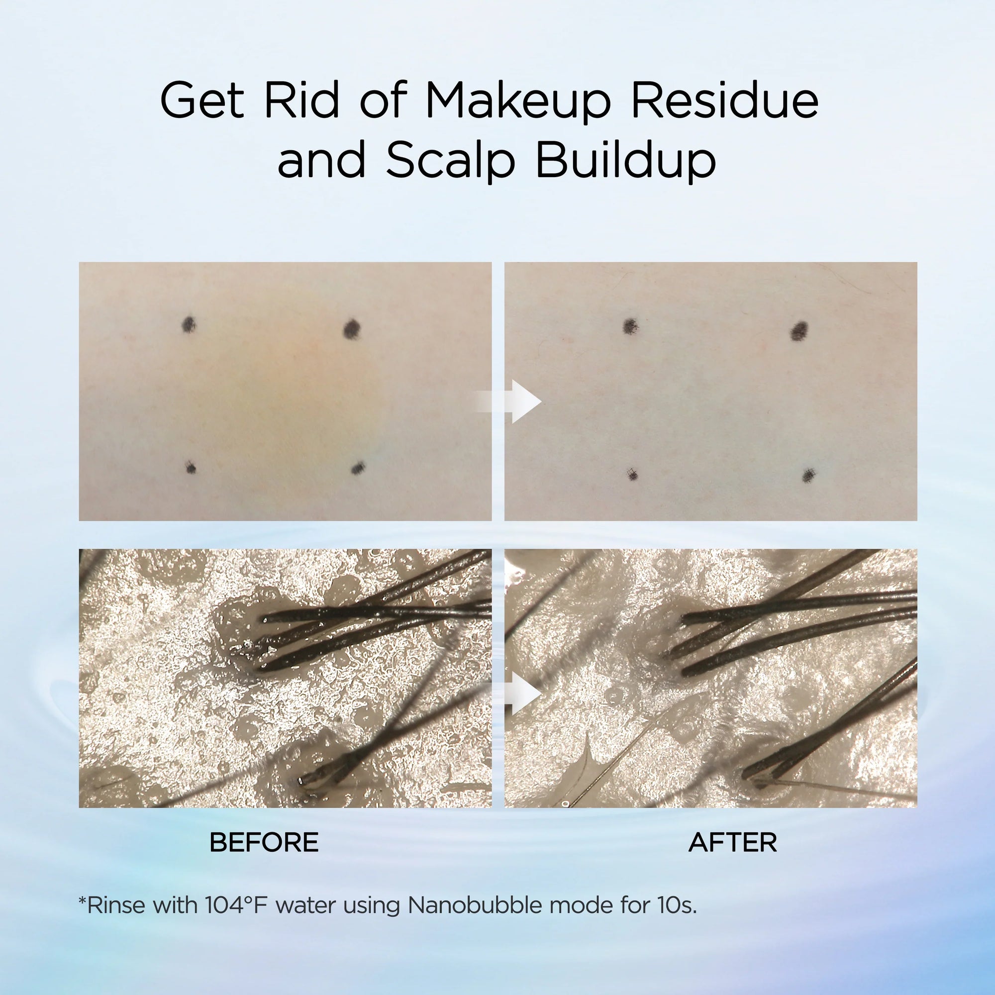 HiHo Fine Bubble +e — Spa de microcorriente y nanoburbujas para una piel luminosa