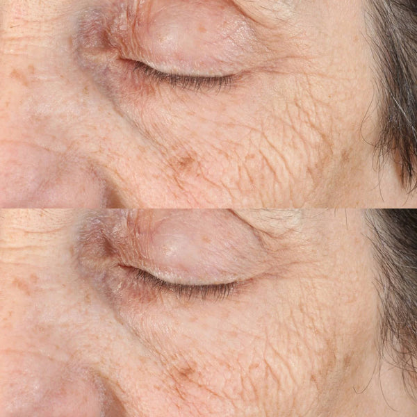 Essential Fx Acyl-Glutathione: Tiefenfaltenserum 