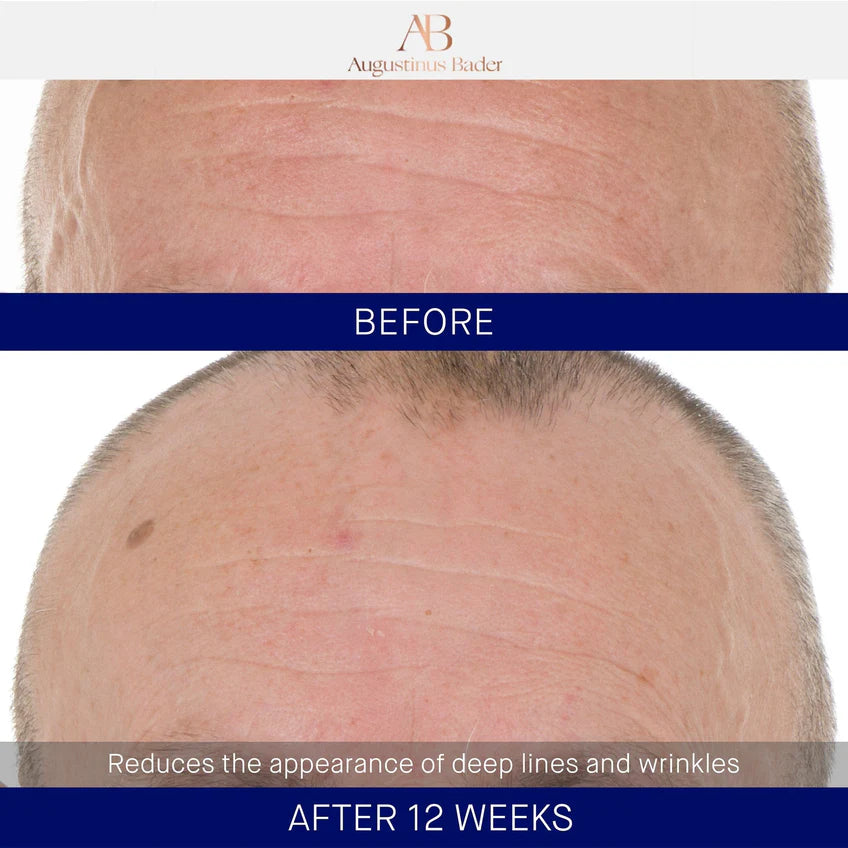 The Retinol Serum - Centro de Estética Itziar y Mariángeles