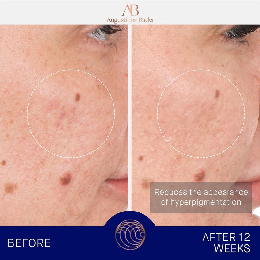 The Retinol Serum - Centro de Estética Itziar y Mariángeles