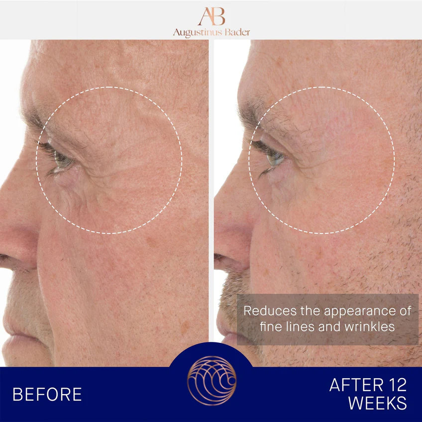 The Retinol Serum - Centro de Estética Itziar y Mariángeles