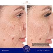 The Retinol Serum