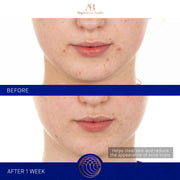 The Retinol Serum