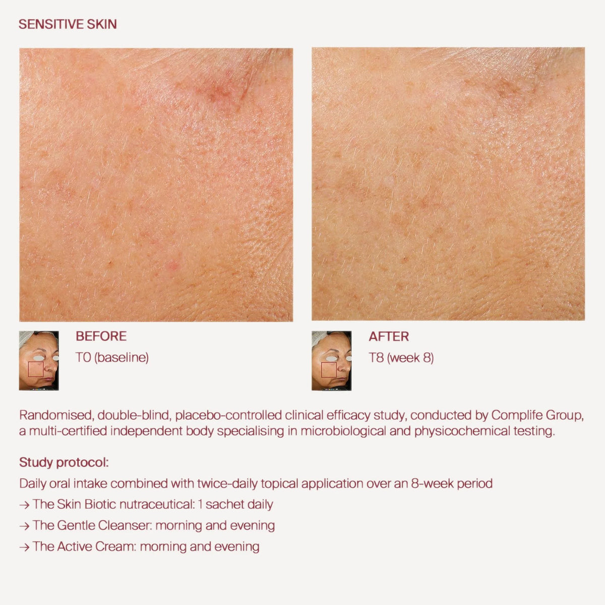The Gentle Cleanser