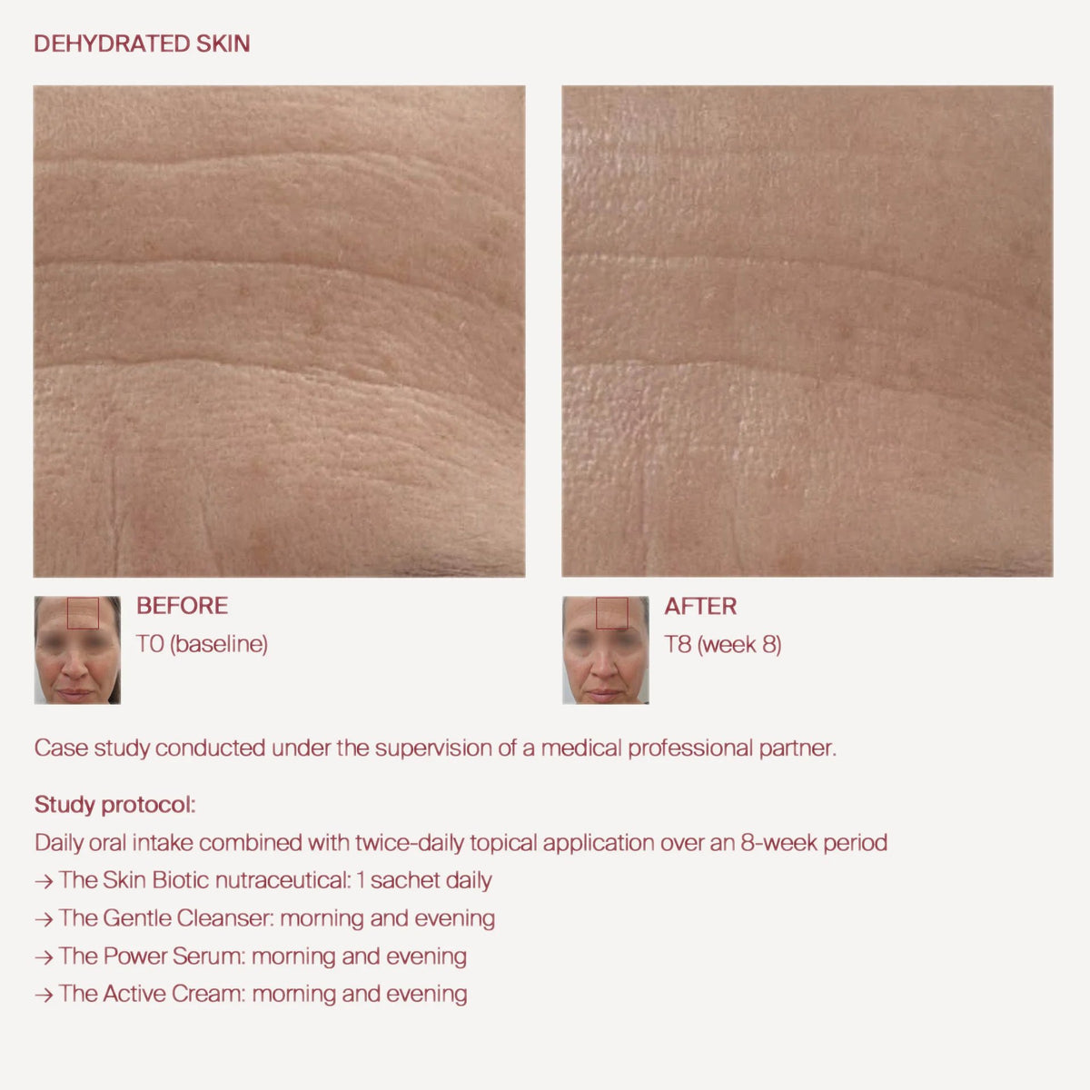 The Skin Biotic