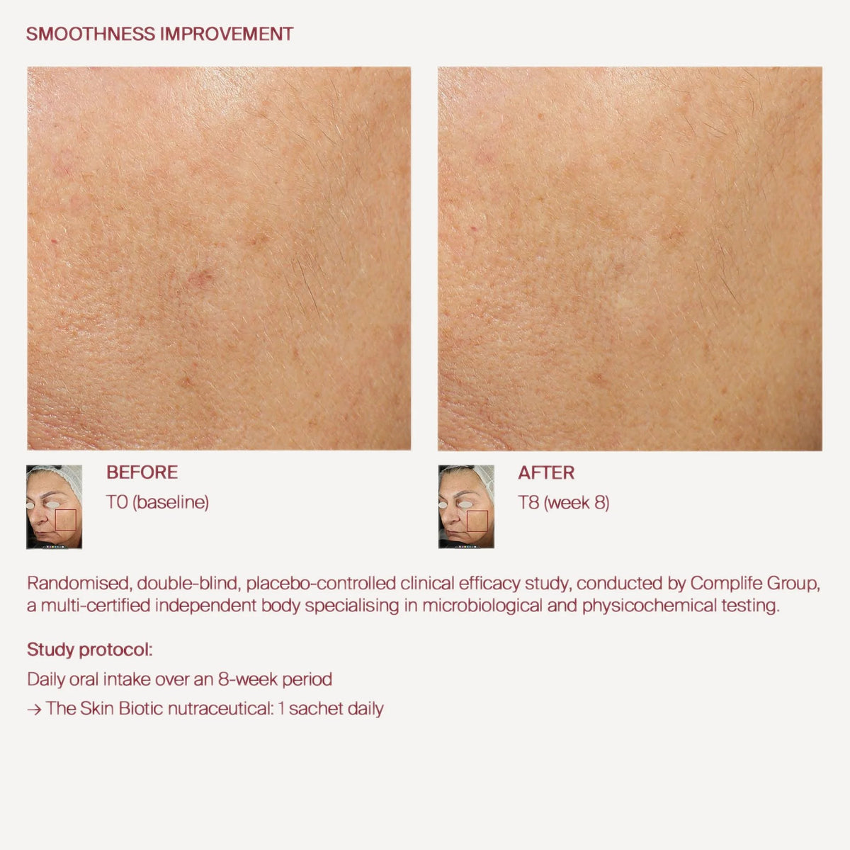 The Skin Biotic