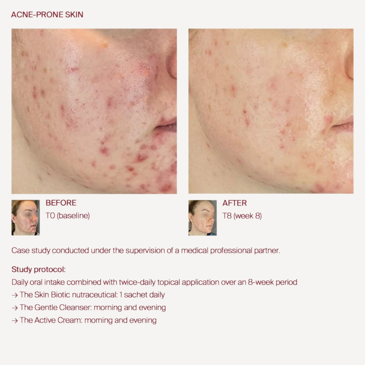 The Skin Biotic