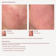 The Skin Biotic