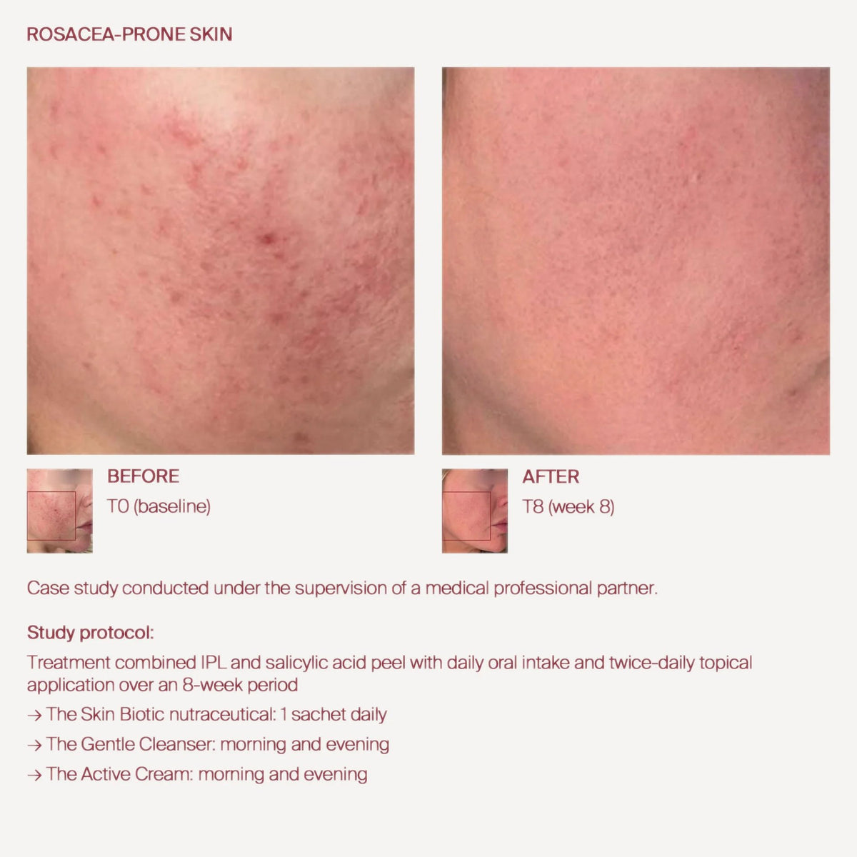 The Skin Biotic