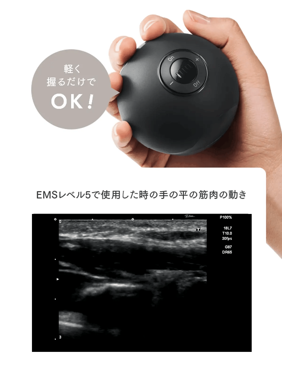 Elexa Hand — Treino de força de preensão com EMS
