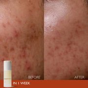 Elixir 30 ml.