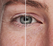 Eye Recipe