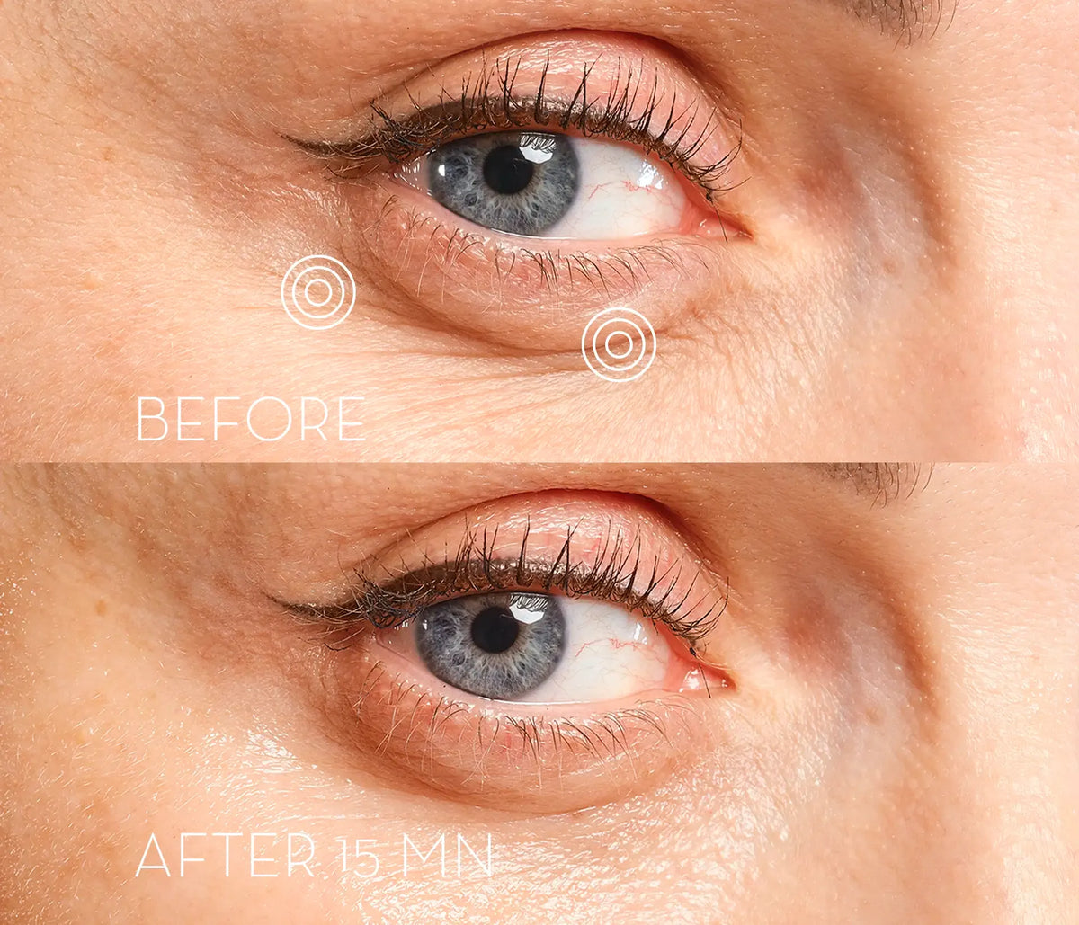 Eye Precision Mask